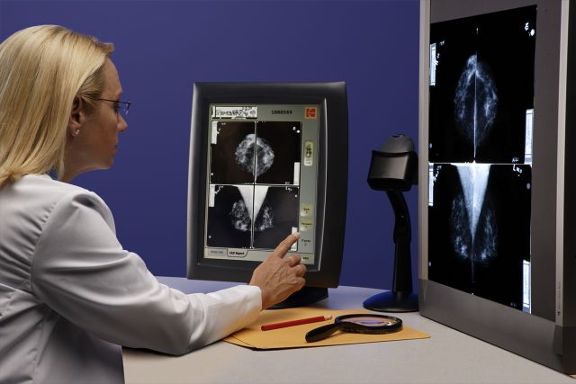 Duže liste čekanja za mamograf