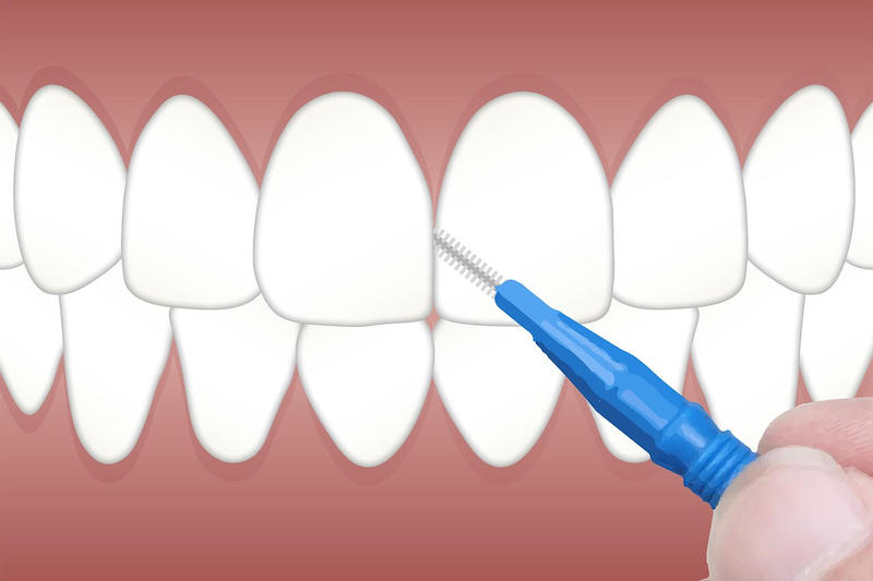 Tražite savjet iz polja stomatologije? Dentis vam donosi sve odgovore na jednom mjestu